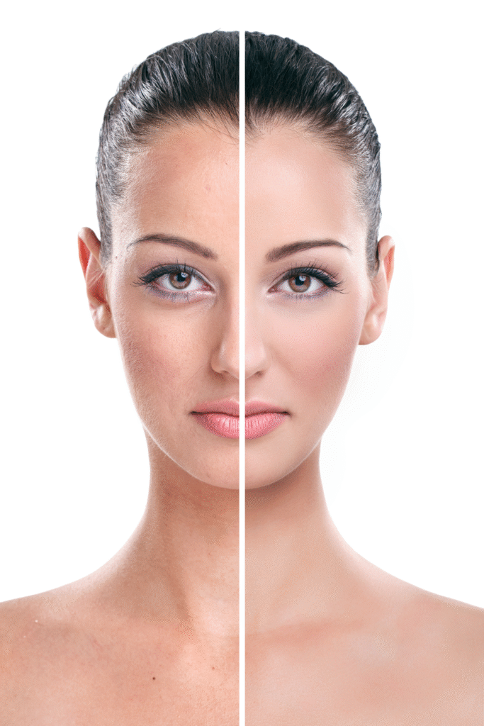 The Power Of HydraFacial 