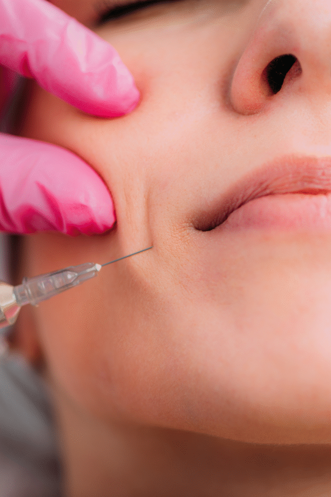  Skin Fillers